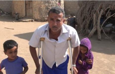 قصة مأساة مزارع جعلته رصاصة قناص حوثي الى مُعاقٍ