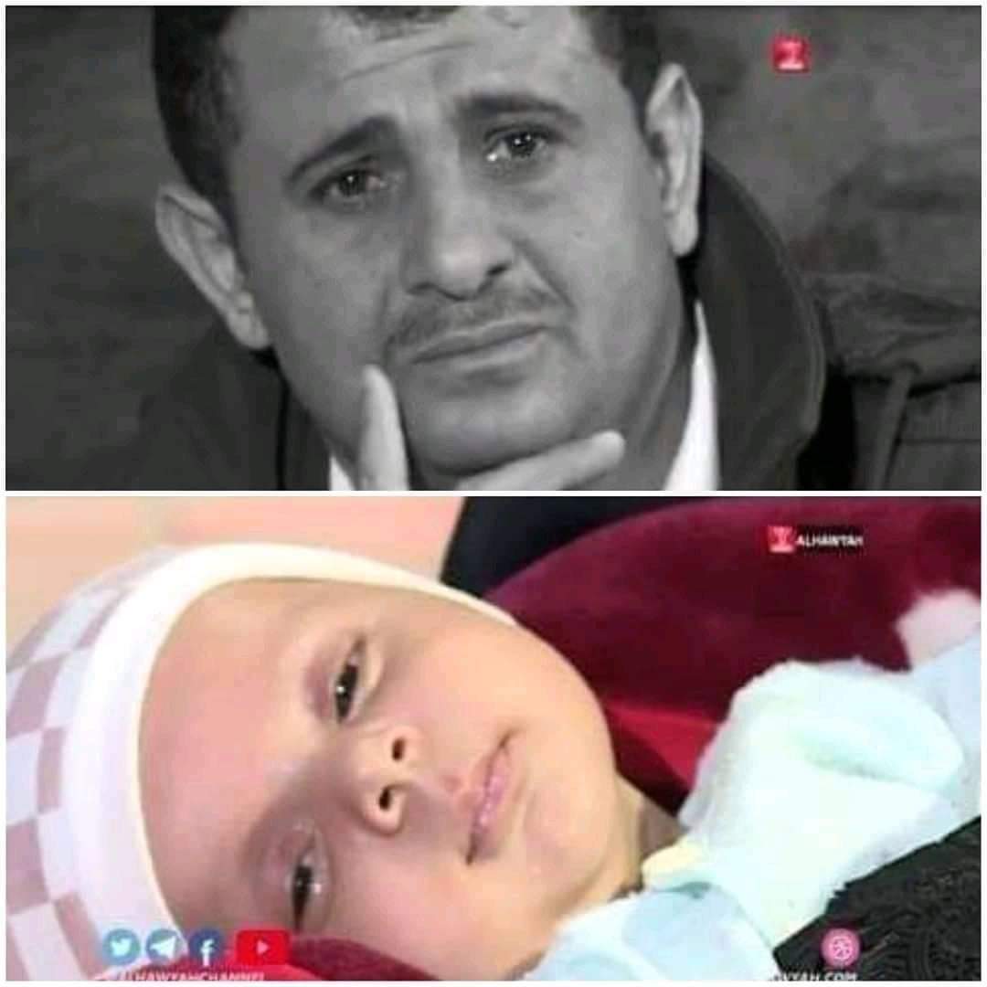 مُحمد الطفل الذي بُتر ذَكره في مُستشفى المزاحن بإب بسبب خطأ طبي