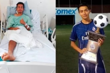 صعقة كهربائية تتسبب في بتر ساق لاعب كرة قدم